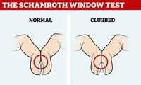  Các tiến bộ trong điều trị ung thư tụy, đường mật 